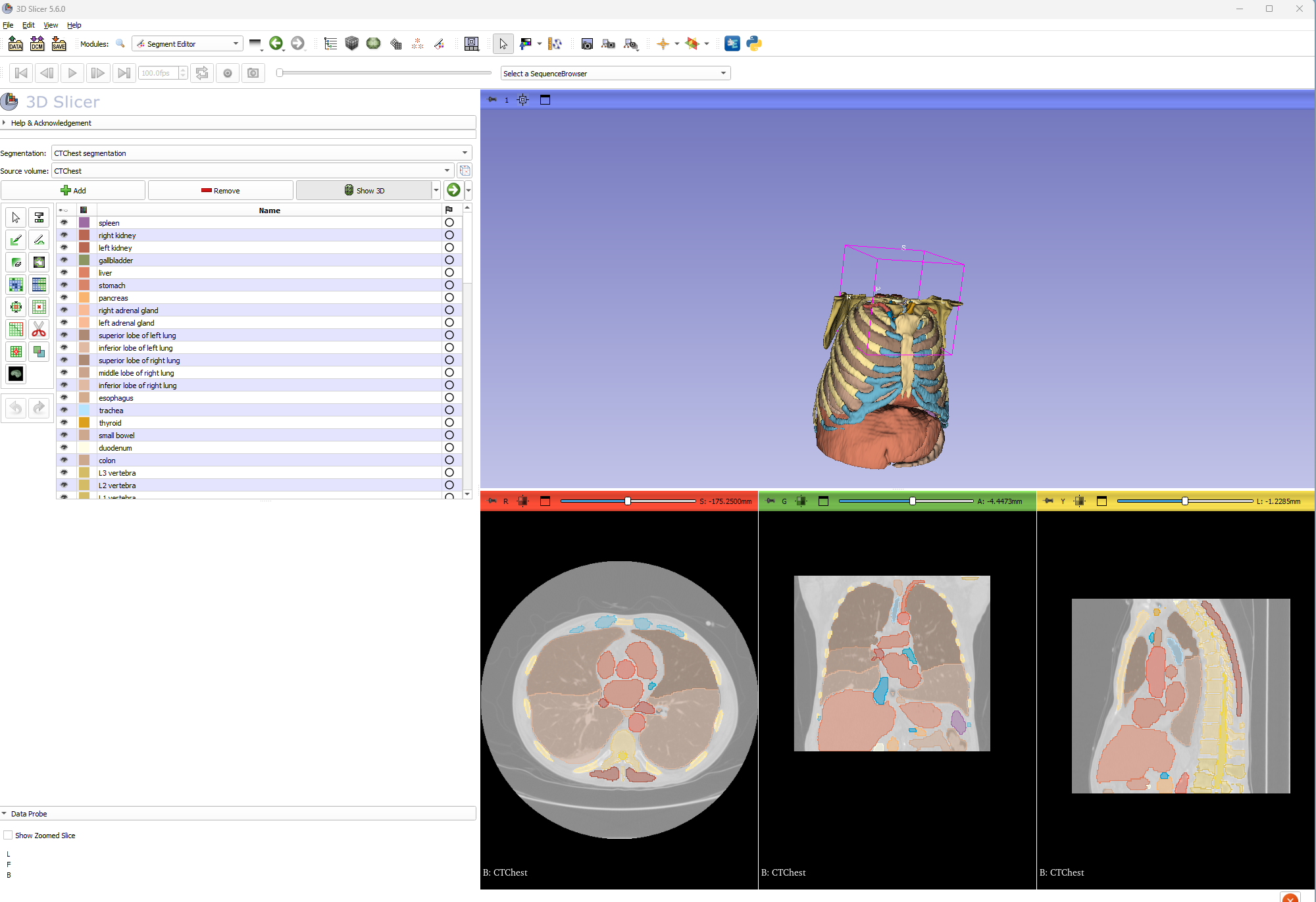 Total Segmentation Analysis